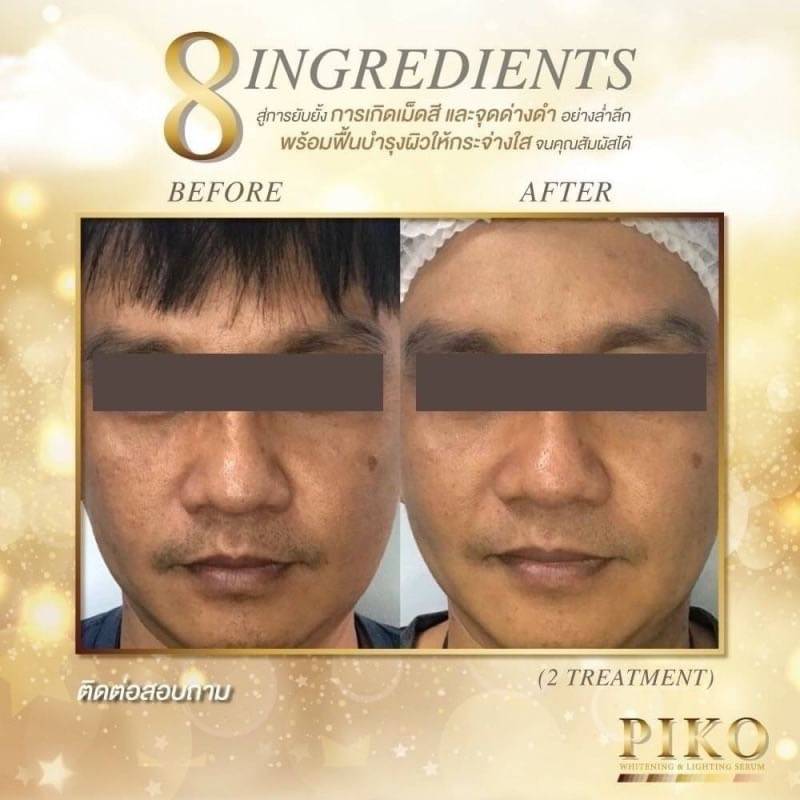 PIKO BRIGHT ALL IN ONE  PIKO  Bright  